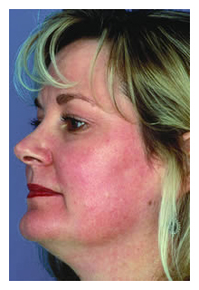 obagi skin care system arizona