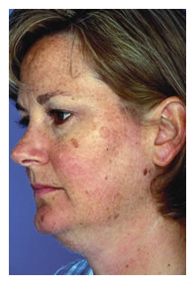 obagi skin care system arizona