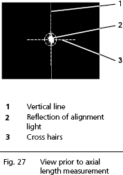 IOLMaster axial length measurement