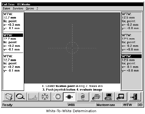 IOLMaster white to white measurement