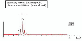 Axial Length Measurement