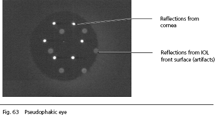 IOLMaster KERATOMETER software