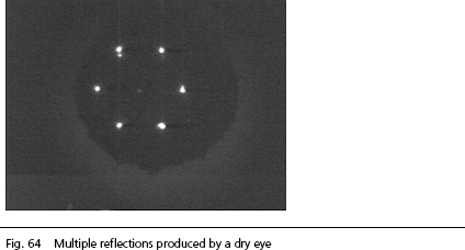 IOLMaster KERATOMETER software