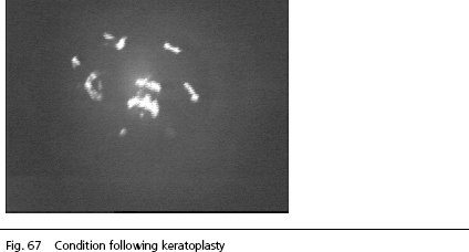 IOLMaster KERATOMETER software
