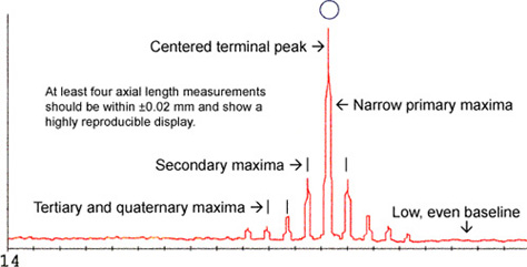 Ideal Axial Length Display