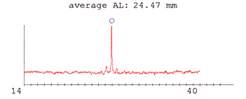Silicone Oil IOLMaster