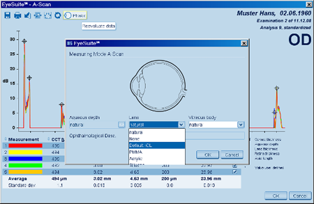 A-scan Details Reevaluate Dialogue LENSTAR Biometry