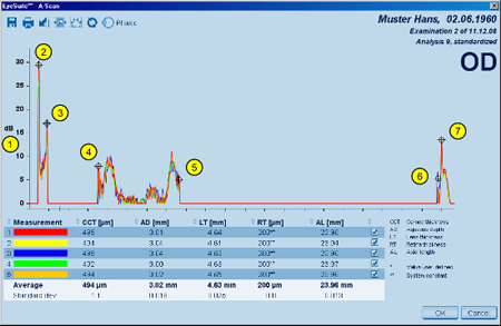 A-scan Details Description LENSTAR Biometry