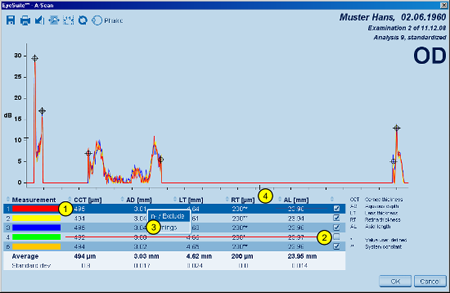 A-scan Details Filtering LENSTAR Biometry