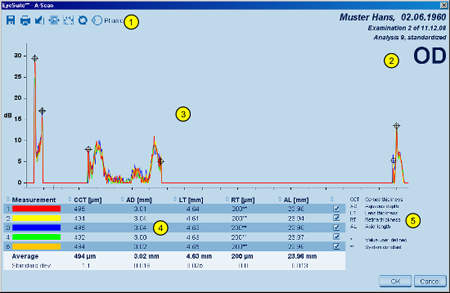 A-scan Details Overview LENSTAR Biometry