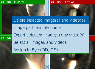 Delete Images LENSTAR Operation Imaging