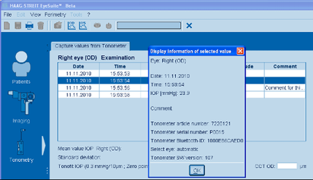 Haag Streit Lenstar Tonometry Display Information