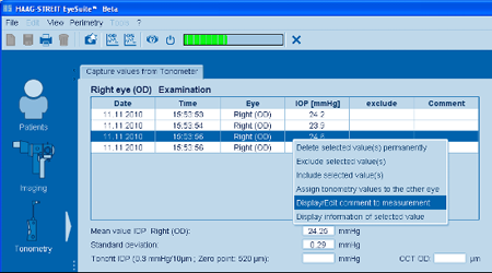Haag Streit Lenstar Tonometry Edit Comment
