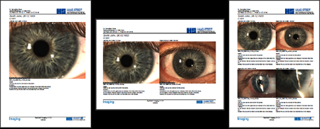 Printout Examples LENSTAR Operation Imaging