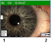 Thumbnail Labels LENSTAR Operation Imaging