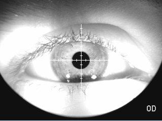 Haag Streit Perimetry OCTOPUS 900 Lens Positioning