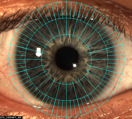 Orientation Grid LENSTAR Operation Imaging