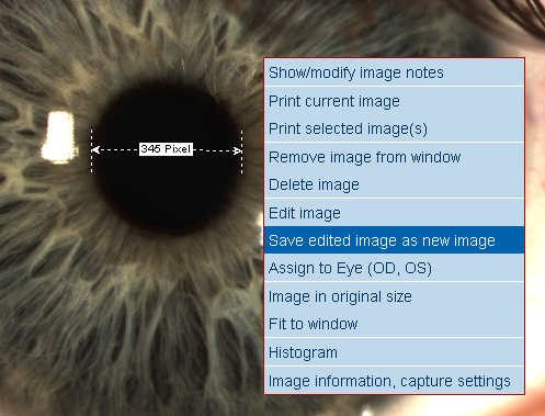 Ruler LENSTAR Operation Imaging