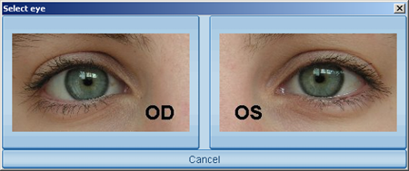 Haag Streit Lenstar Tonometry Select Eye