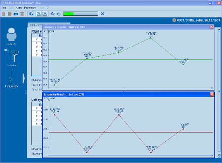 Haag Streit Lenstar Tonometry Graphics