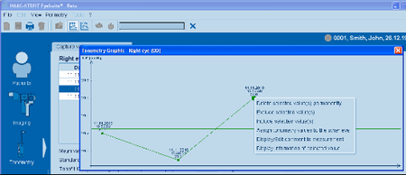 Haag Streit Lenstar Tonometry Right Mouse