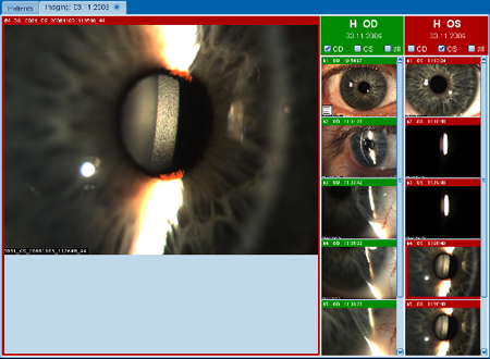 Viewing Images LENSTAR Operation Imaging
