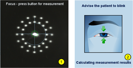 Measurement Progress LENSTAR Biometry