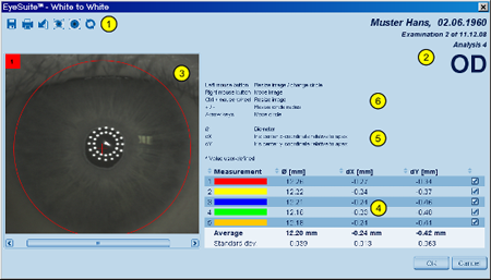White to White Details Overview LENSTAR Biometry