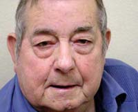 Patient 8 Before Plastic Surgery Mesa Arizona