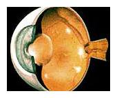 Diabetic retinopathy arizona