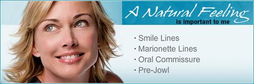 Radiesse Mesa, Arizona