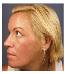 Kalil Medical Products