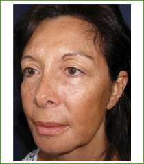 Kalil Medical Products