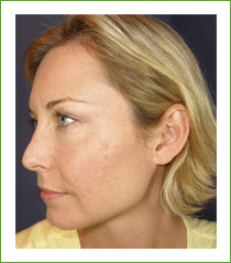 Kalil Medical Products