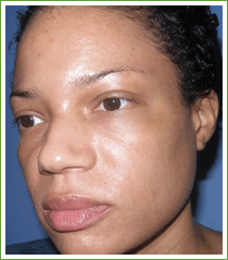 Kalil Medical Products