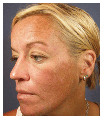 Kalil Medical Products