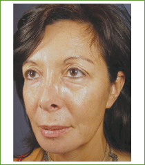 Kalil Medical Products