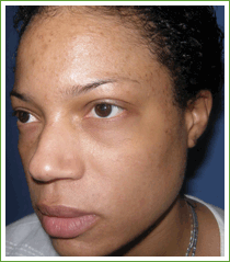 Kalil Medical Products