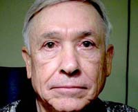 Patient 7 After Eyelid Surgery Mesa Arizona