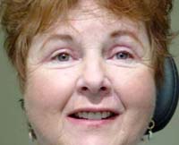 patient photo, plastic eyelid surgery in Mesa, AZ