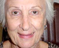 patient photo, plastic eyelid surgery in Mesa, AZ