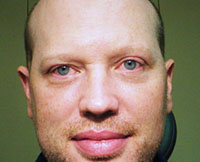 patient photo, plastic eyelid surgery in Mesa, AZ