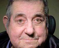 patient photo, plastic eyelid surgery in Mesa, AZ