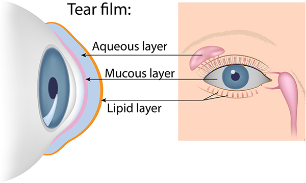 Dry Eye Syndrome