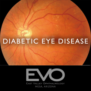 Diabetic Eye Disease