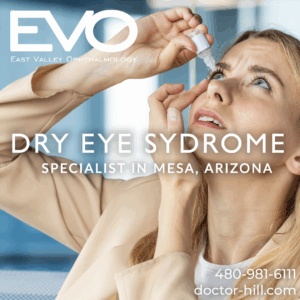 Say Goodbye to Dry Eyes!