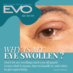 Why is my eye swollen?