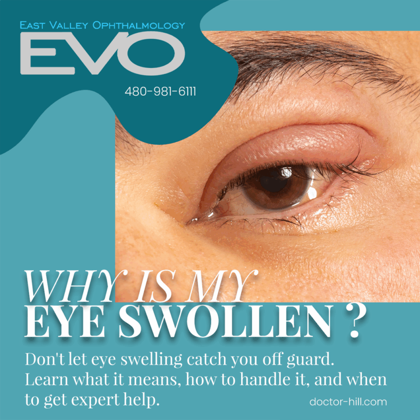 Why is my eye swollen?