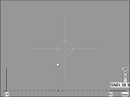 IOLMaster axial length measurement