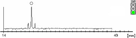 Axial Length Measurement